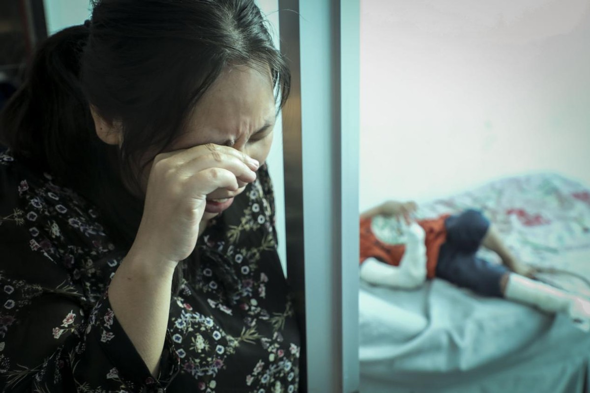 孩子被开水烫伤母亲却只心疼杯子,小孩掉进开水盆80%烫伤