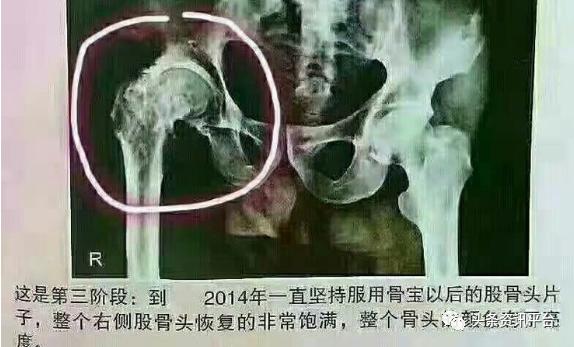 乐利来是合法直销吗,乐利来是正规直销吗