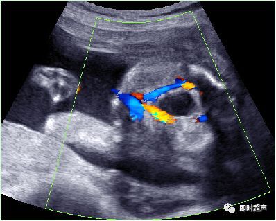产科常规彩色超声报告单介绍,常见妇科疾病超声报告