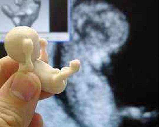 人工流产的胎儿怎么处置,人工流产的胎儿去哪了