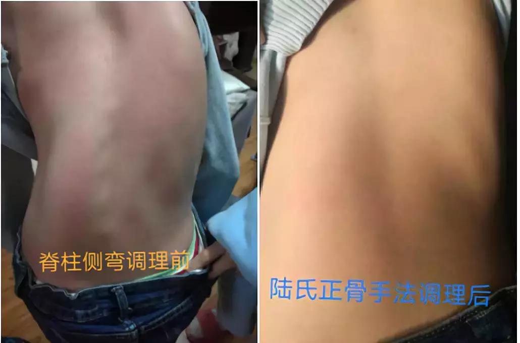 中国排名第一的正骨哪里最有名,陆氏正骨