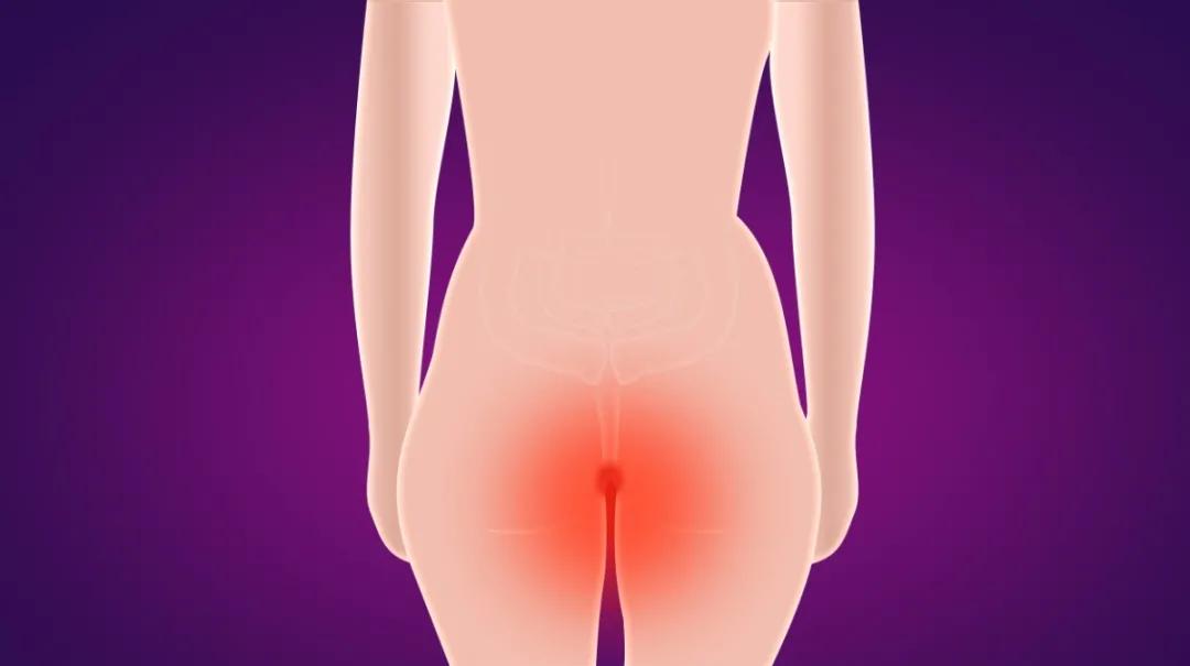 北京东大肛肠医院肛瘘,北京东大肛肠医院有肛瘘微创吗