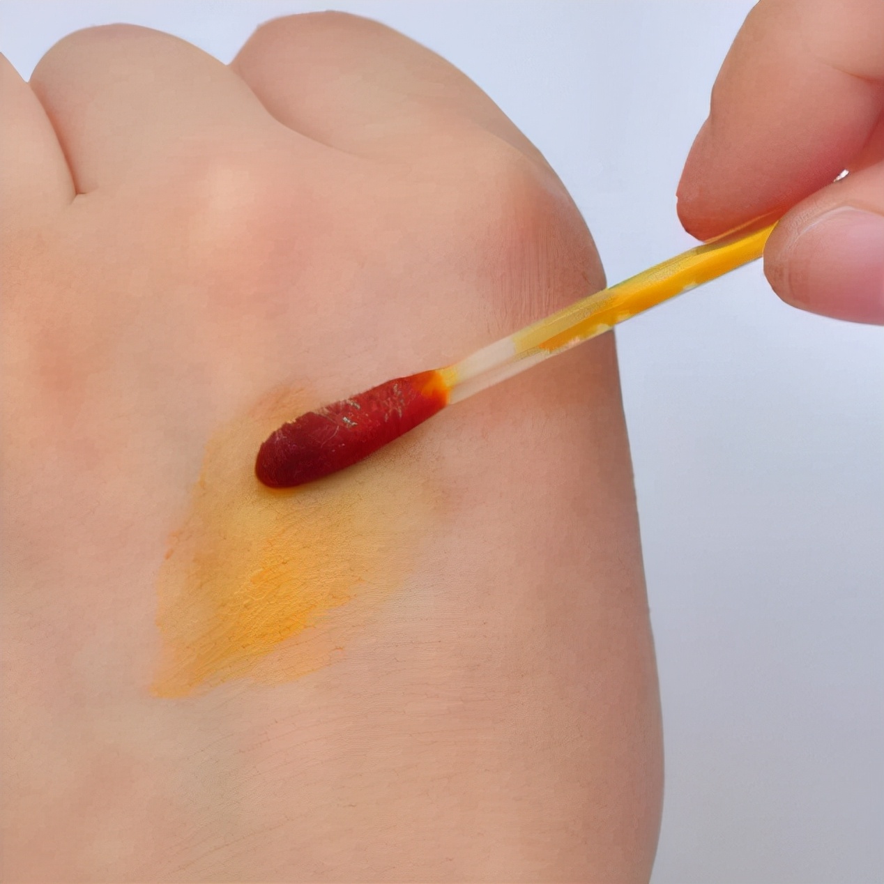 烫伤伤口结痂了肿了吃什么消炎药,烫伤后擦药膏变灰褐色了