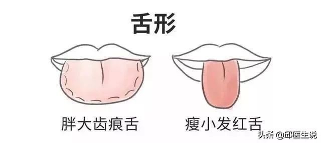 解决身体的湿气的偏方,身体湿气太重自己在家怎样除掉