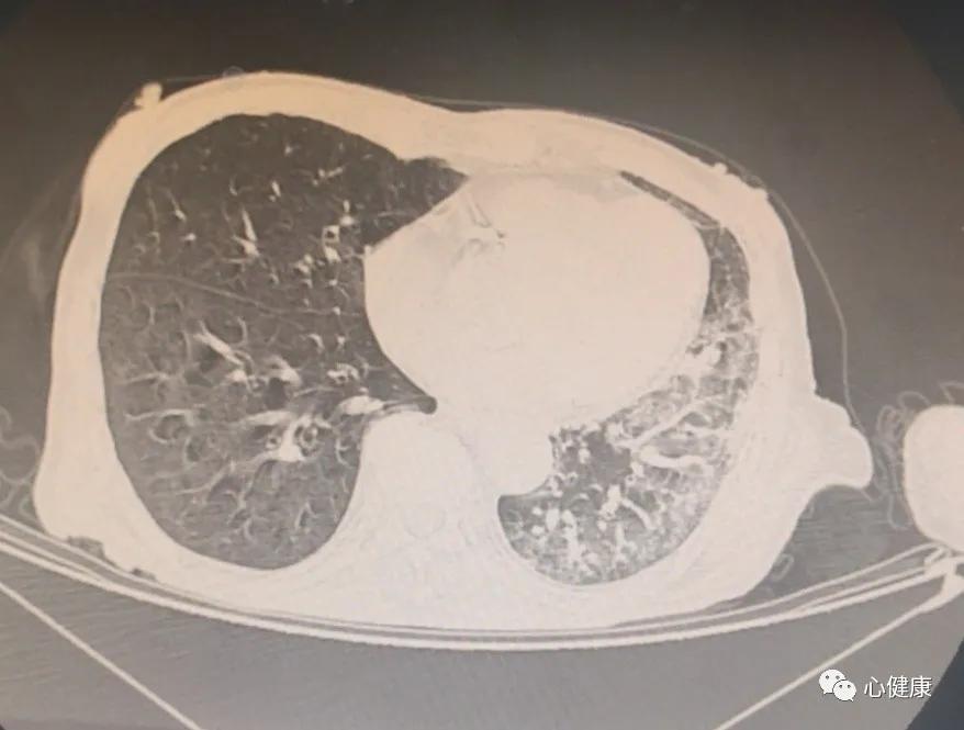 一块牛肉引发的事,一块肉引发的血案电影解说