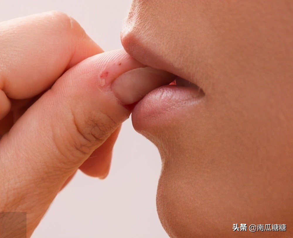 小孩抠手指头皮是缺什么,小孩儿总抠手指头是缺哪种维生素