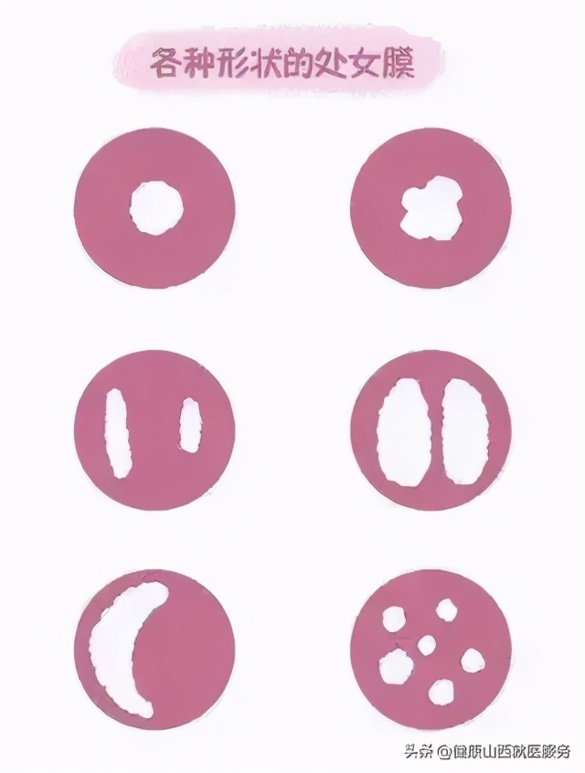 第一次*生活性**一定会流血？处女膜到底有啥作用？科普的解释来了
