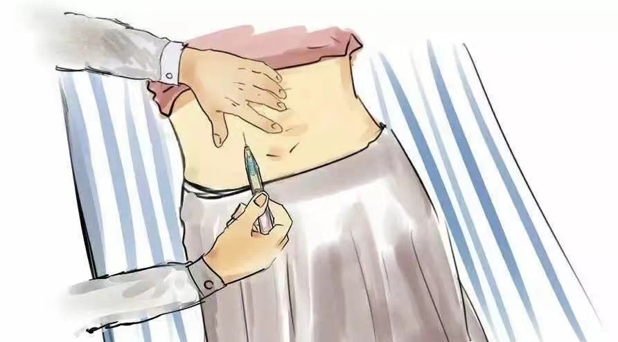 解决肿瘤患者顽固性呃逆优秀案例分享