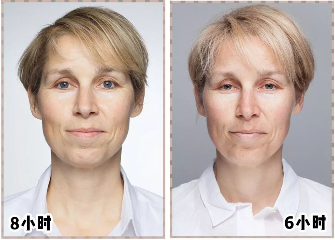 脱发为什么会丑,原来你的头发是这样长出来的