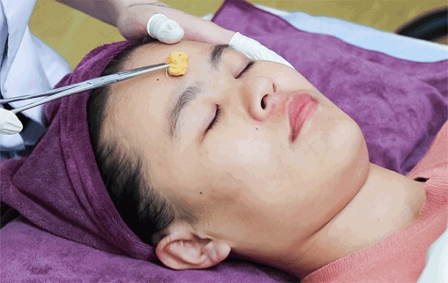 福州如何有效祛痘坑,福州快速祛痘