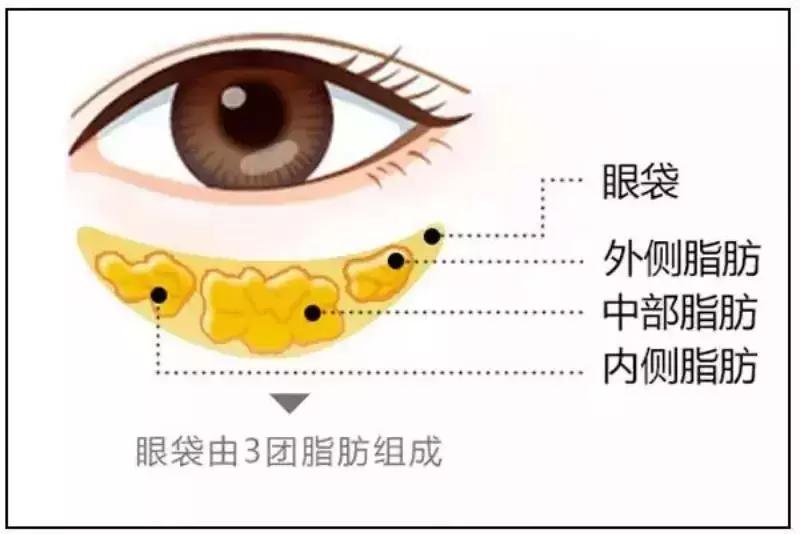 化妆真的能完全遮住瑕疵吗,化妆也掩盖不了岁月的痕迹