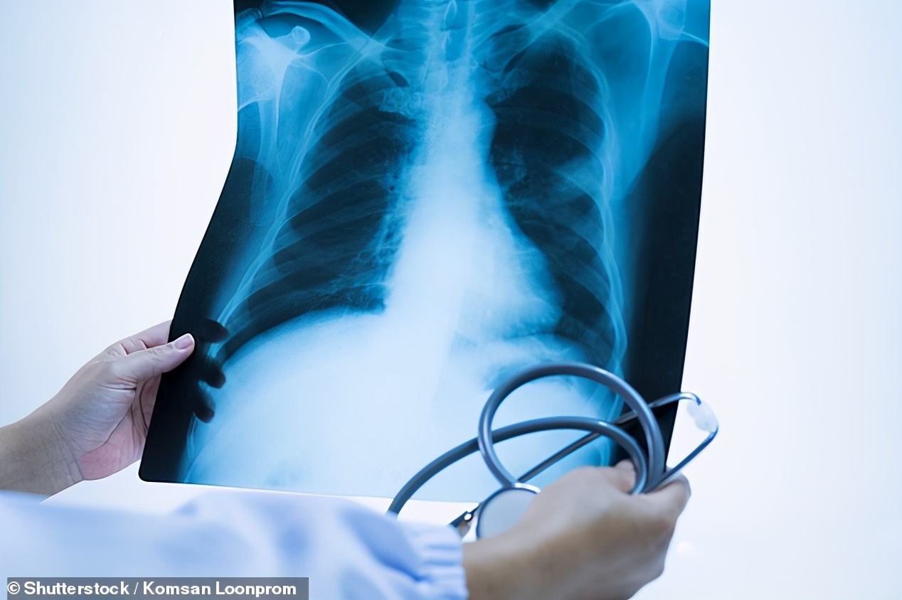 低密度胆固醇降到1还吃他汀吗,低密度胆固醇降下来还吃他汀吗