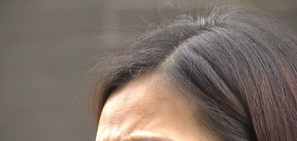 打近6万的美容针女子竟惨遭毁容,女子花4万打美容针没效果