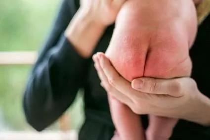 怪不得宝宝总是红屁屁，原来是这里出了问题！