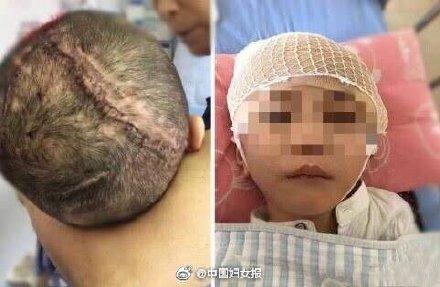 男童被继母虐待成植物人,生父被以虐待罪及遗弃罪起诉