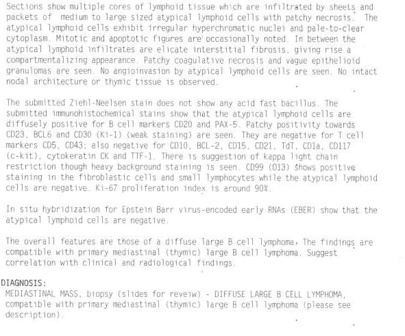 花5000万在美国治好癌症,去美国花了二十万检查癌症