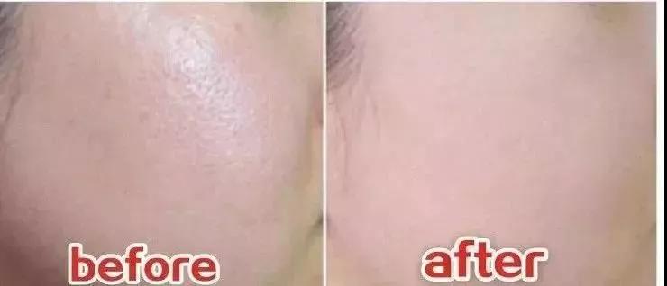 好皮肤怎么样养成的,好脸蛋