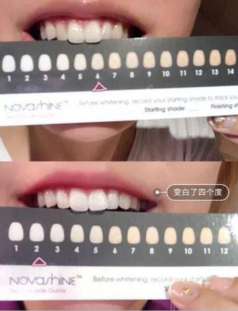 杨颖和姚晨演技,姚晨和杨颖谁的嘴巴大