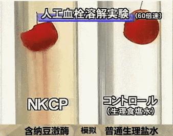 藕粉好消化吗给消化不好的病人喝,消化不好吃什么坚果比较好消化呢