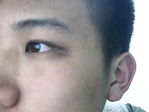 肝脏变黑的三个地方图,肝变硬前预兆