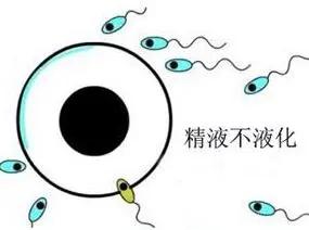 尴尬！久备不孕埋怨妻子不会生，竟不知是自身“小蝌蚪”在作怪