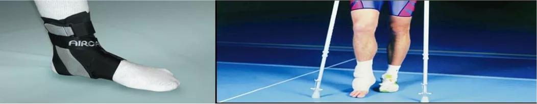 运动损伤的治疗与康复知识点,运动损伤的诊治