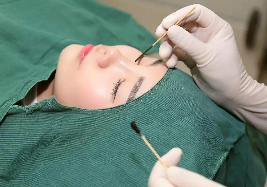 毛孔粗大真实修复对比,毛孔粗大拯救全过程