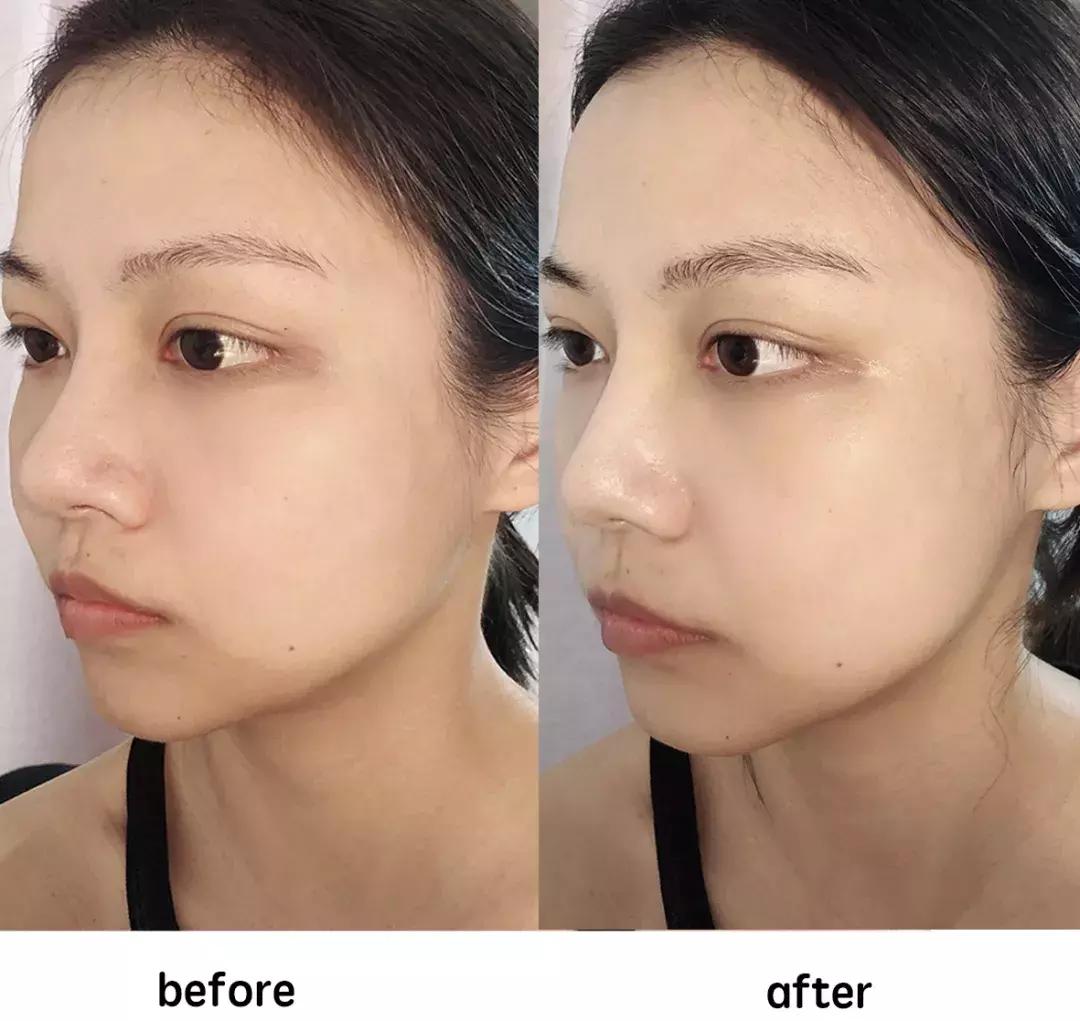 不要被面膜骗了,千万别被美容院忽悠