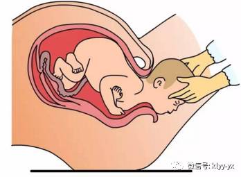 孕妇分娩前都在做什么,孕妇分娩的时候胎儿在忙着什么