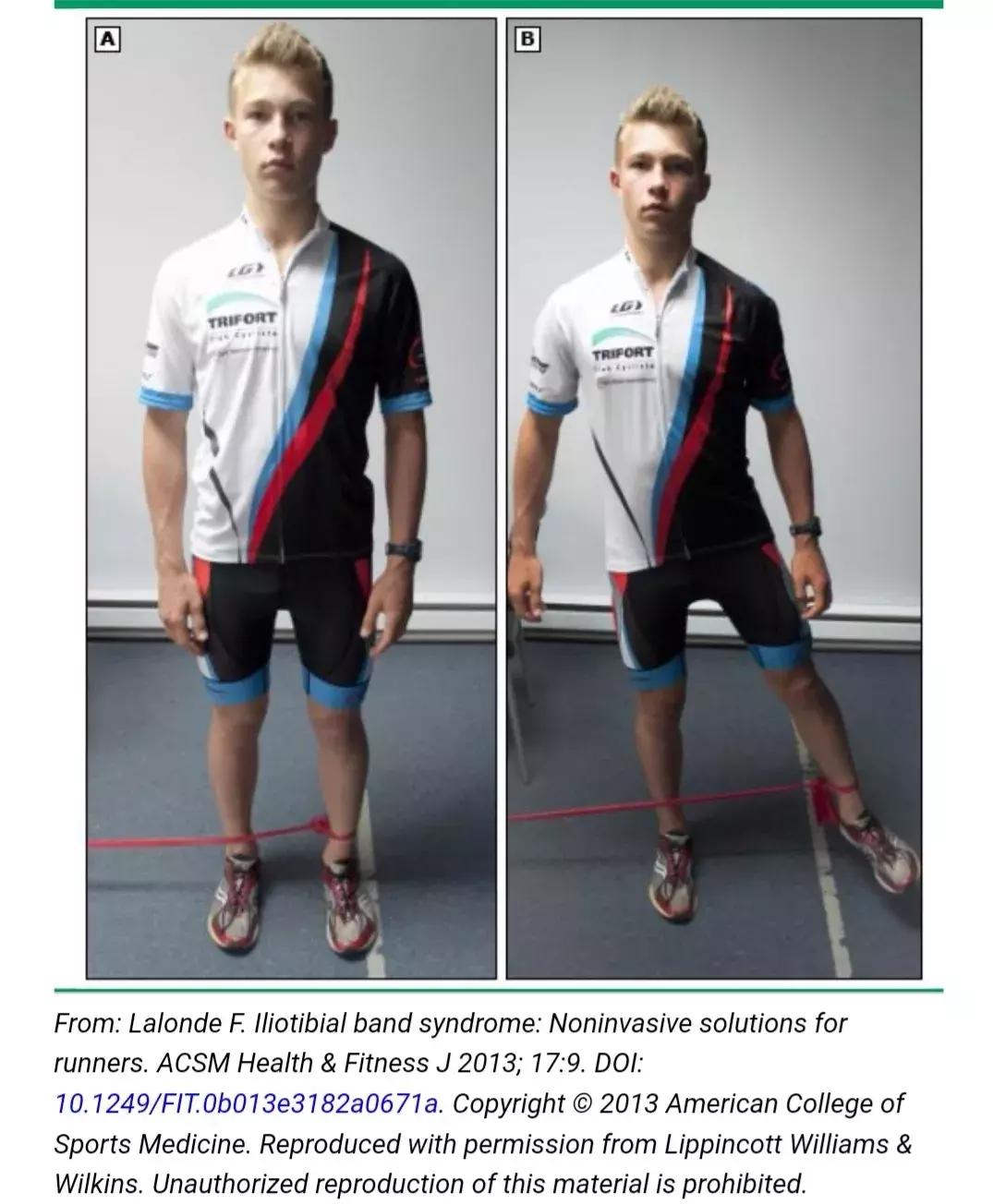 跑步膝盖髂胫束疼痛怎么治疗,跑者最怕的疾病