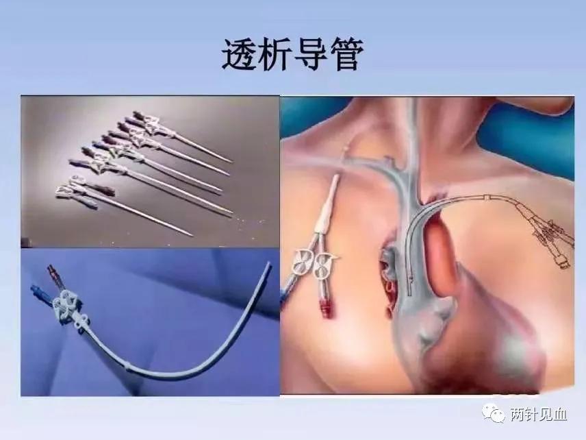 透析针眼渗血处理方法,透析后流鼻血是什么原因