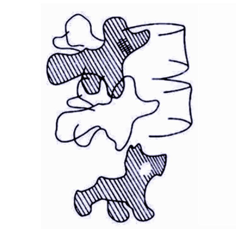 青少年脊柱弯曲危害科普视频,脊柱病科普小常识大全