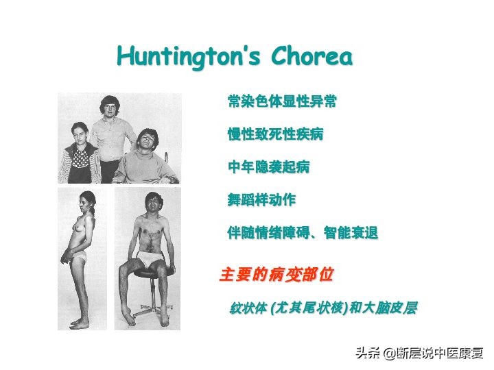 中枢神经系统断层解剖讲解,中枢神经3d解剖动画