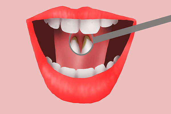 牙齿掉一点怎么补牙,牙齿掉落的补救