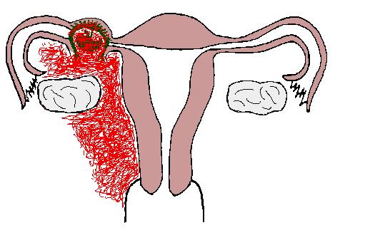 孕妇进了介入室会怎么样,怀孕了到医院路过介入科有影响吗