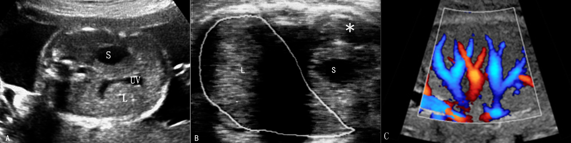 孕期不能忽视的胎儿超声检查,胎儿超声检查报告表