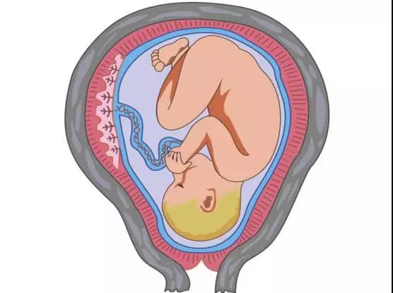 孕13周便秘用力排便对胎儿的影响,孕晚期便秘出血对胎儿有影响吗