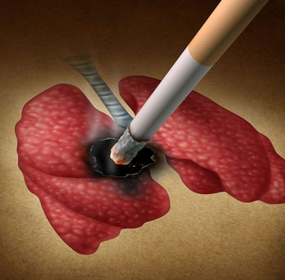 世界上五种最强辐射,家里的最强辐射是吸烟者的肺