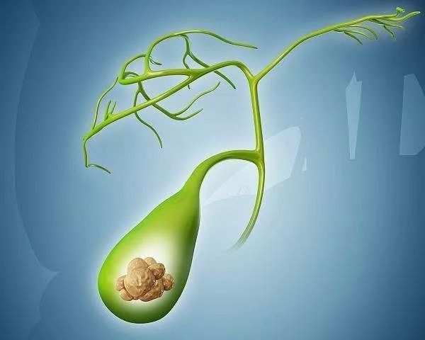 身体有结节囊肿息肉怎么调理,为什么总是长囊肿息肉结节等疾病