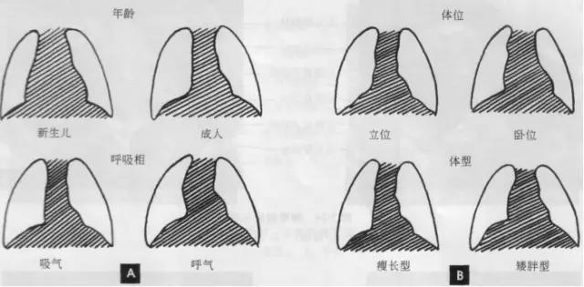 详细的胸部X线解剖，最基础最实用！