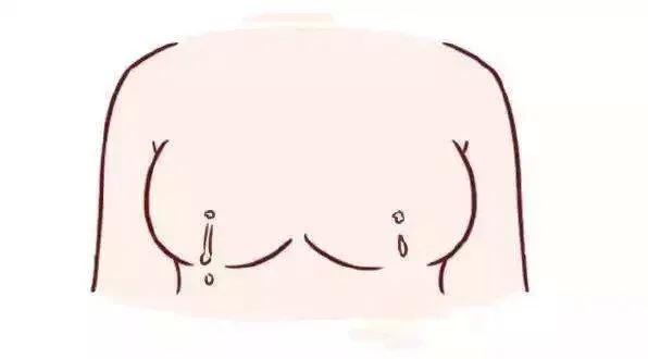 60岁乳腺增生怎么回事,乳腺增生怎么消除最快有效