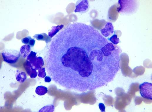 如果有轻微痔疮要怎么改善,得了痔疮不要怕食疗简单又方便