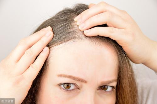白发怎么变黑最快最有效的方法,白发变黑发最快而有效的方法