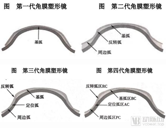 角膜塑形镜上海市场分析,角膜塑形镜各品牌市场占有率