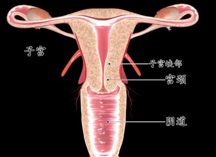 宫颈上环避孕,备孕宫颈糜烂需要用保妇康栓吗