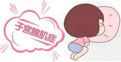 腺肌症伴肌瘤最好的治疗方法,子宫多发肌瘤伴有腺肌症怎么治