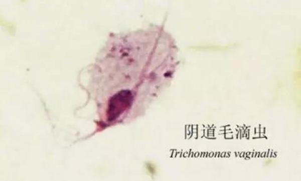 遭遇难“炎”之隐，很多女性居然选择这样做……