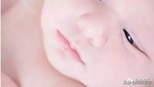 口唇干裂起皮是什么原因引起的,宝宝口唇干裂