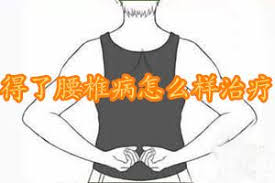 颈腰椎病的最佳锻炼方法,治疗腰椎病的方法