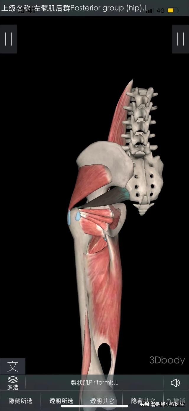 腰椎间盘突出和骨质增生怎样缓解,抗骨质增生片对腰间盘突出有效吗